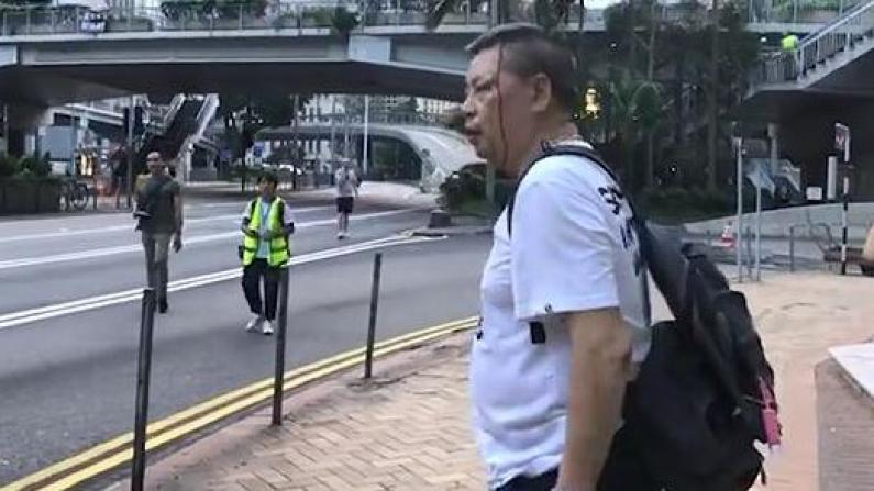 （粗口慎入）香港示威暴徒穷凶极恶 打爆市民头