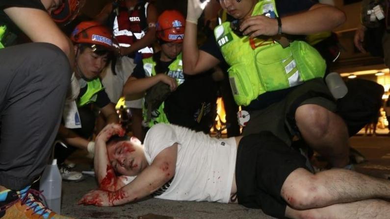 触目惊心！香港示威暴徒残忍围殴市民