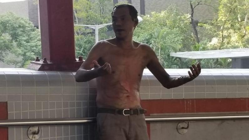 香港市民遭浇油火烧命危 视频还原暴徒凶残手段