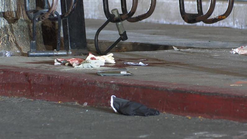 拒戴口罩再引纠纷 加州男子遭超市保安刺伤