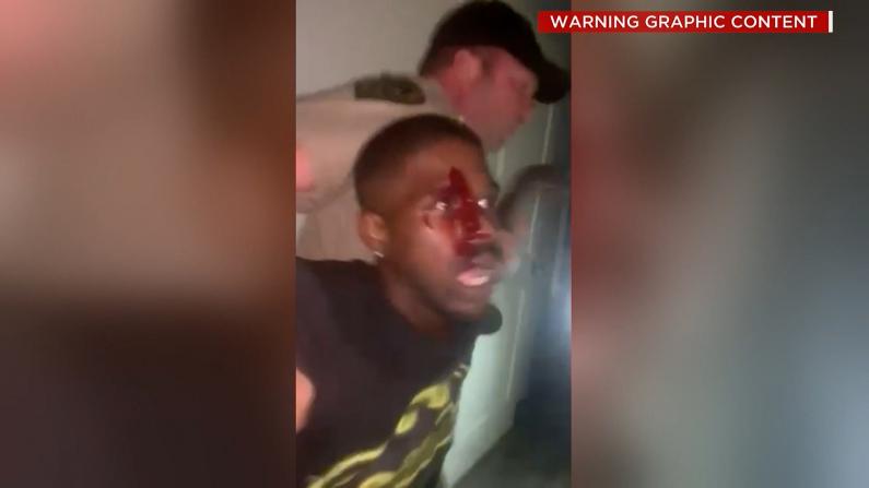 【現場】交通違規引發電擊毆打 田納西警方疑再涉針對非裔暴力執法